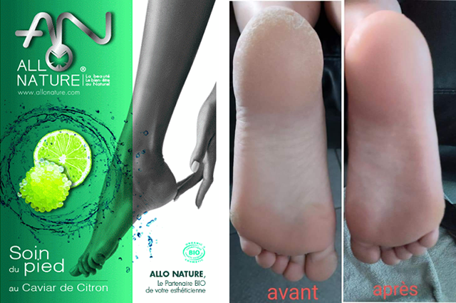 Kaluspeeling Bio (Soin des pieds)